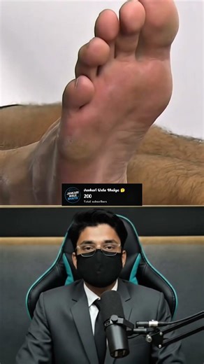 Do You Have Babinski Reflex #shorts #facts