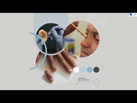 Sculpting a facial prosthesis manually is becoming redundant Newer Technologies have simplified