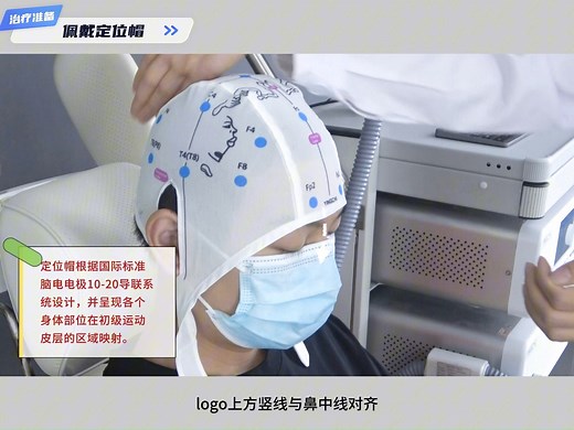 英智TMS：M系列经颅磁刺激仪实操视频