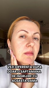 ✨ Vezi ce se întâmplă cu pielea ei după o săptămână de folosire a produselor din gama COLAGEN Plus, cu 8 tipuri de collagen natural 👉https://cosmeticplant.ro/collections/colagen-plus | COSMETIC PLANT