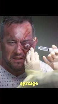 His Eyeball Was About to Explode #shorts