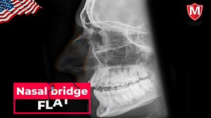 🇺🇸NCLEX RN Trainer🇺🇸 https://www.youtube.com/channel/UCKLm4ko9XEyahCJ-fBaPuCg Subscribe my youtube channel 👆 ☎️7025634403☎️9072540339 #nclex #nclexrn #rn #nclexexam #nclexrnexam #nursing #NCLEX_RN #nclexrnexam #NCLEX #RN #nclexstudying #nclexquestions #nclextips #medical #ainstin #Medline #Uworld #Kaplan #archer_review | Ainstin