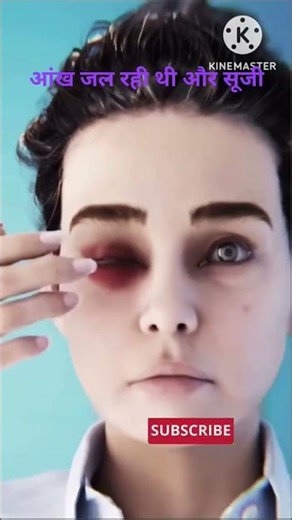 Contact Lens Stuck Inside Eye 😱 Doctors Shocked by This Real Case #science fact #educational #viral