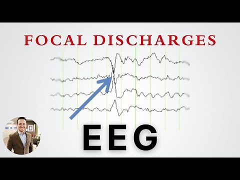 Focal Discharges on EEG and what they mean in Epilepsy