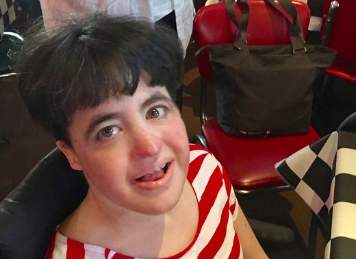 Megan Hayes (full Trisomy 18) Turns 40 years Old! | SOFT