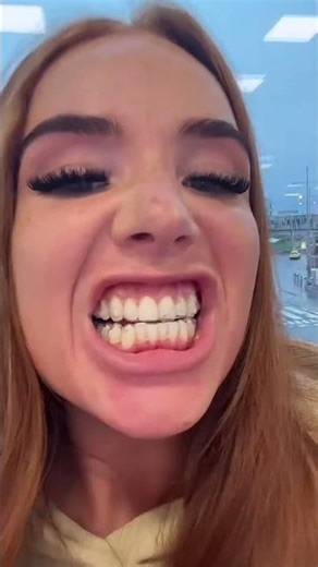 evolution of the Invisalign orthodontic appliance