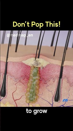 Don’t Pop This!