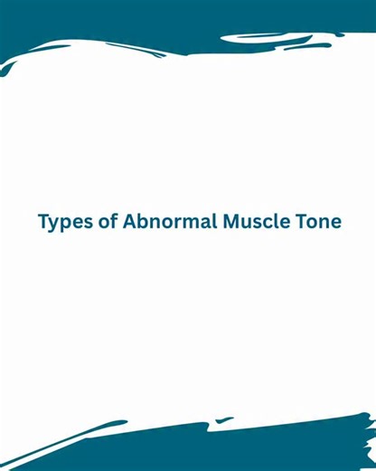 Dr.Aarti shah on Instagram: "Understanding muscle tone disorders is essential for assessing neuro and ortho patients. Here’s a quick guide to Hypotonia, Hypertonia, Flaccidity, Spasticity, Rigidity, Dystonia & Paratonia — simplified for easy clinical use. Each tone tells a story about the nervous system, and knowing the difference helps you treat better.🔥✅ #physiowithaarti #physiotherapy #physiotherapist #physiotherapystudent #physioeducation #neurologyphysio #muscletonedisorders #hypotonia #hy