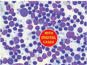 Cytology of the Lymphoid System - online CPD/CE course