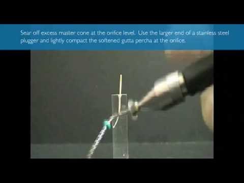 Obtura Technique for Warm Vertical Obturation