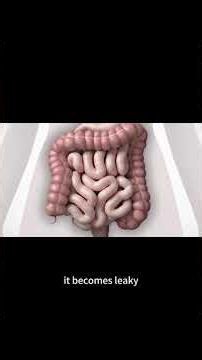 The "Leaky Gut" Theory of Glaucoma 👀 (Mind-Blowing!)