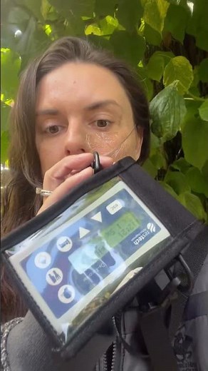 24-hour pH Impedance Testing