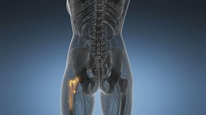 Advanced techniques speed recovery after hip replacement