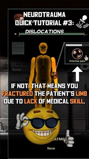 Neurotrauma Tutorial: Dislocations #barotrauma