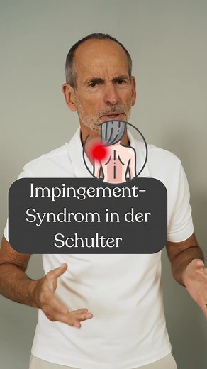 Shoulder Impingement Relief: Effective Exercises and Tips