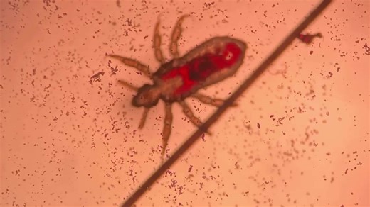 The Disgusting Truth About Mao Zedong's Personal Hygiene