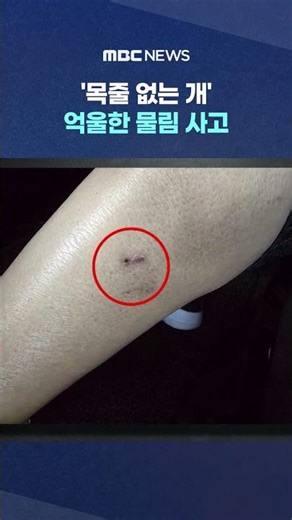 '목줄 없는 개'‥억울한 물림 사고 #Shorts (MBC뉴스)