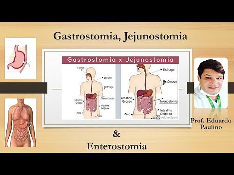 Gastrostomia, Jejunostomia e Enterostomia - Prof. Eduardo Paulino