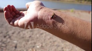 treatment by honey bee sting. closeup honey bee stinging a hand. close up bee worker. bee : apis mellifera. insects, insect, animal, wildlife, wild nature, forest, woods, garden beauty of pollination