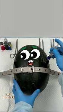Life Doodles | Operation Crazy Watermelon with a Belt, Worms 😂 #lifedoodles #shorts #animation
