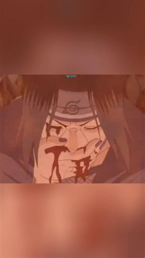 The illness was stronger than the Susano'o | The SAD end of Itachi SUMMARY