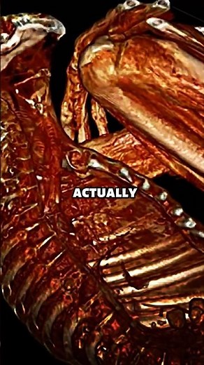 What CT Scans Revealed Inside the Nazca Mummies