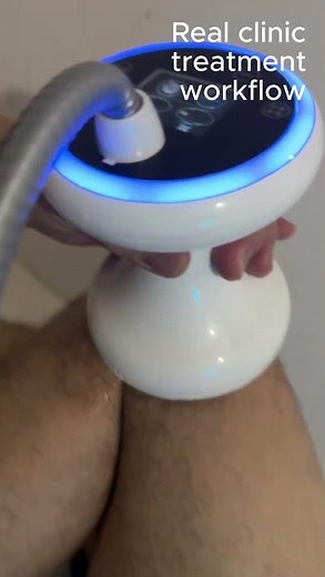 Focused Shockwave Device — Professional Clinic Use