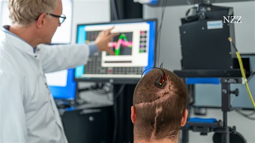 Hirn-Computer-Schnittstellen: Michis Gedanken bringen den Cursor in Bewegung