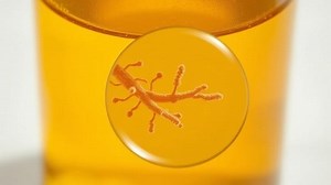 can botulism grow in vinegar? - Test Food Kitchen