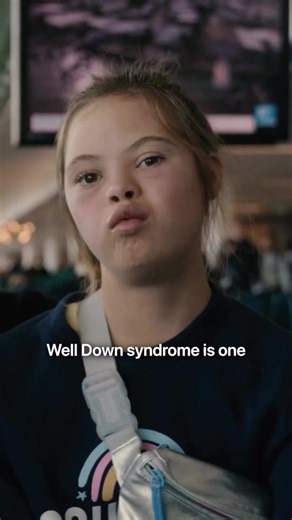 "Some kids have Down syndrome or does not have Down syndrome, but it's...