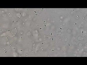Human live sperms in semen Microscopy in 4K