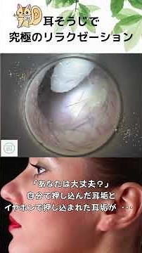 「あなたは大丈夫？」自分で押し込んだ耳垢とイヤホンで押し込まれた耳垢が・・・ #イヤーエステ #耳掃除 #eariss #イヤーエステ #耳掃除 サロン#耳かき動画