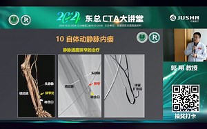 四肢血管CTA扫描技术，后处理及诊断要点