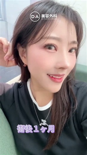 ［韓国整形］目と鼻整形だけでもここまで垢抜ける✨綺麗ならDA🩷［DA美容外科