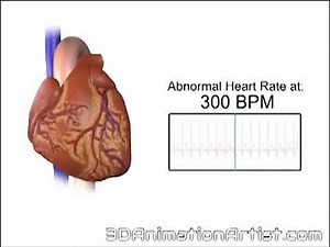 Heart Beatin at 300 BPM