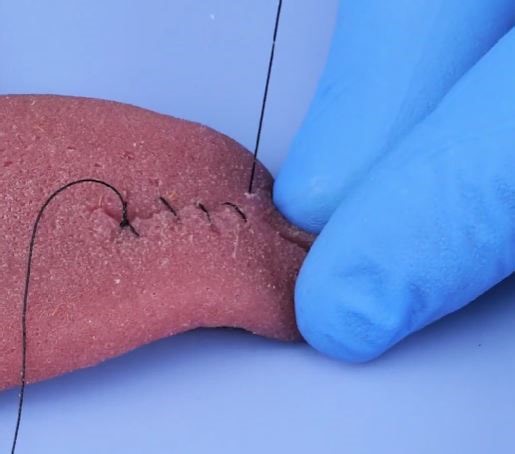 499K views · 528 reactions | Expert Medical Stitches in Action | 5-Minute Crafts | Facebook