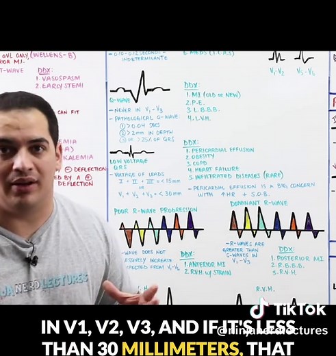 Understanding Low Voltage QRS Complexes in ECG Interpretation