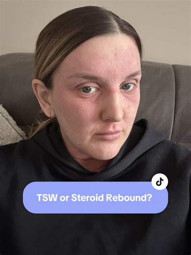 Understanding TSW and Steroid Rebound Effects