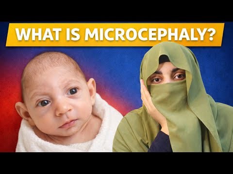 What is Microcephaly | Reason, Precautions & Treatment | Choty saar Waly bachy | Dr. Bisma Jahanzeb 