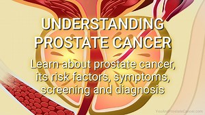 You and Prostate Cancer