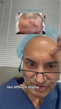 SCAR REVISION RESULTS - DR. TANVEER JANJUA