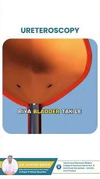 No Cut Kidney Stone Removal | How Ureteroscopy Works Explained Simply!