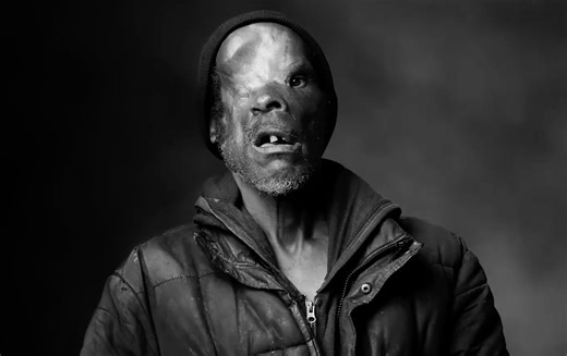 专访枪击幸存者Jerry：失去前脑，惊叹医学奇迹并庆幸活着