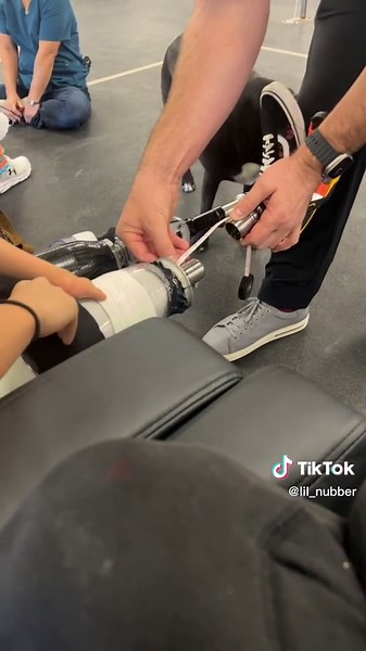 These aren’t the final legs just test sockets :) #prosthetic #running #runninglegs#blades #runningblades #fypシ #foryoupage #nubs #fyp #amputeelife #orlando #inspiration