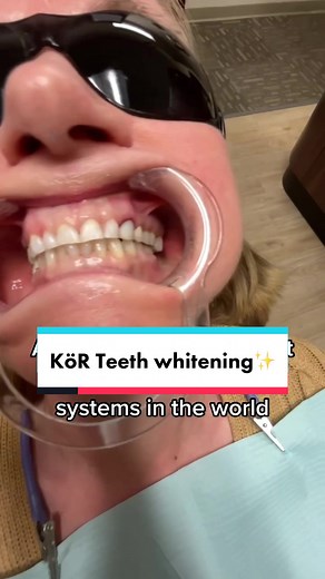 The average cost of the Kör Whitening system is $900. Would you try it??🦷✨ #korwhitening #teethwhitening #dentistry #whiteningteeth #dentistoffice #dentaltiktok