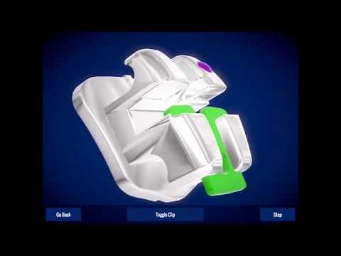 How to Open & Close EasyClip+® Brackets