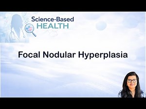Understanding Focal Nodular Hyperplasia of the Liver