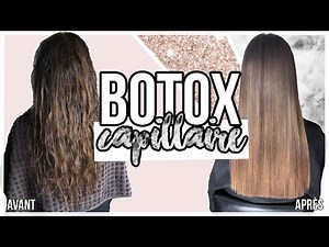JE TESTE LE BOTOX ! 1 MOIS PLUS TARD ?! 😱🤩