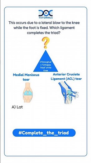 O’Donoghue’s Unhappy Triad Explained | FMGE Ortho Must-Know