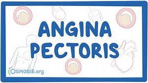 Angina pectoris: Video, Causes, & Meaning | Osmosis